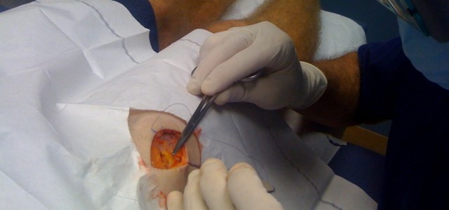 Sonnnencreme nicht vergessen